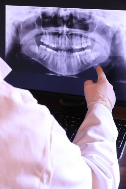 Best Broken or Cracked Tooth Emergency Dentist in Lakeland, GA